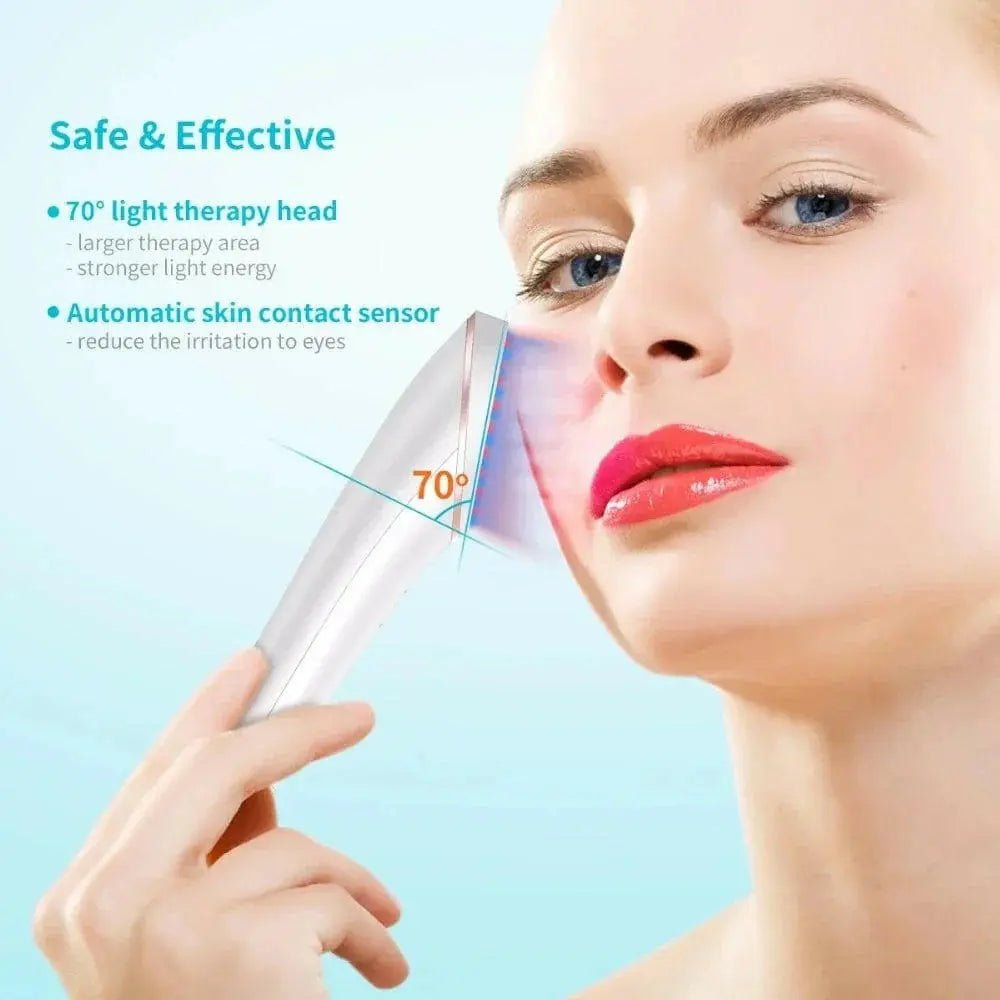 BlueMote™ - Women's Acne Light Therapy 50% Off - Luau Loot