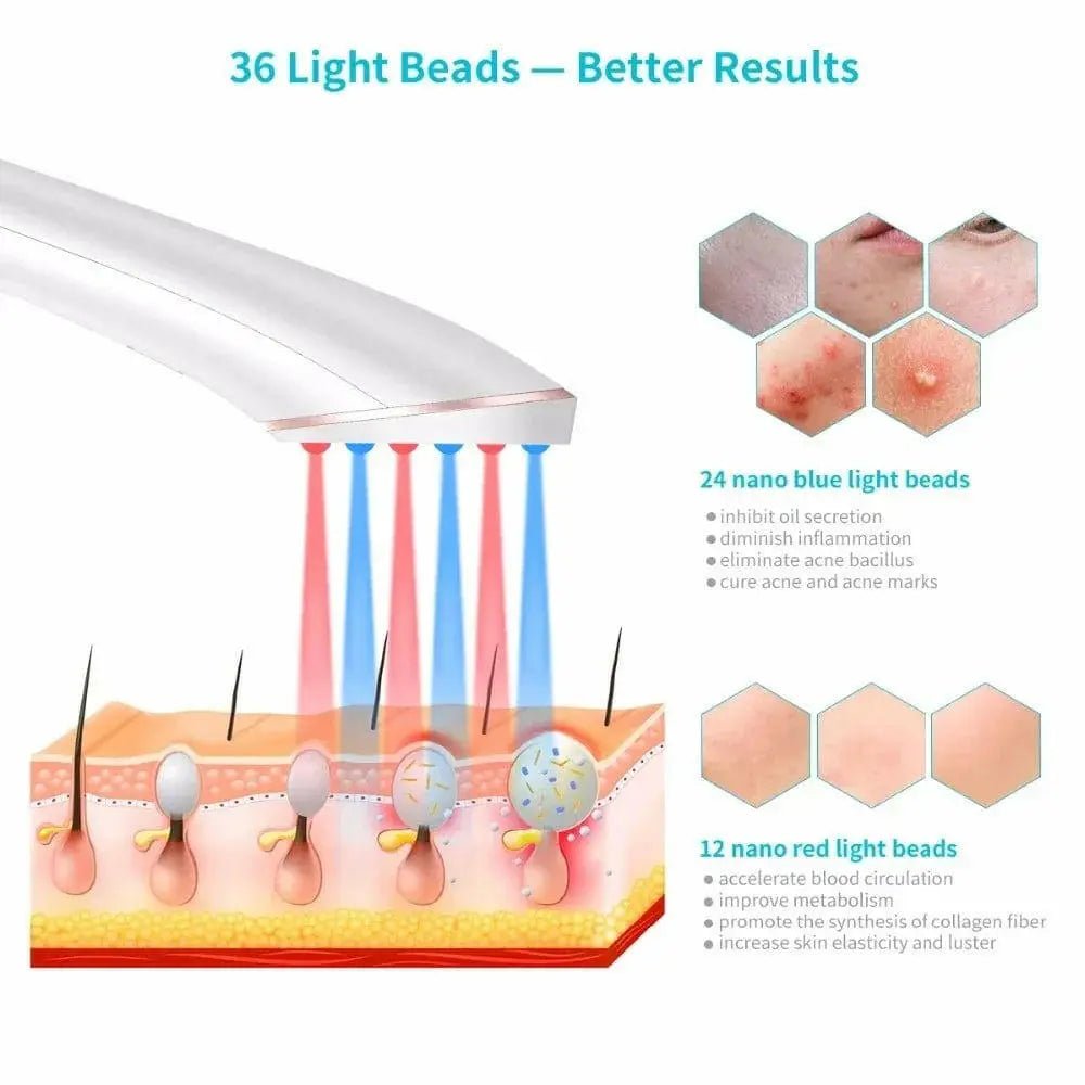 BlueMote™ - Women's Acne Light Therapy 50% Off - Luau Loot