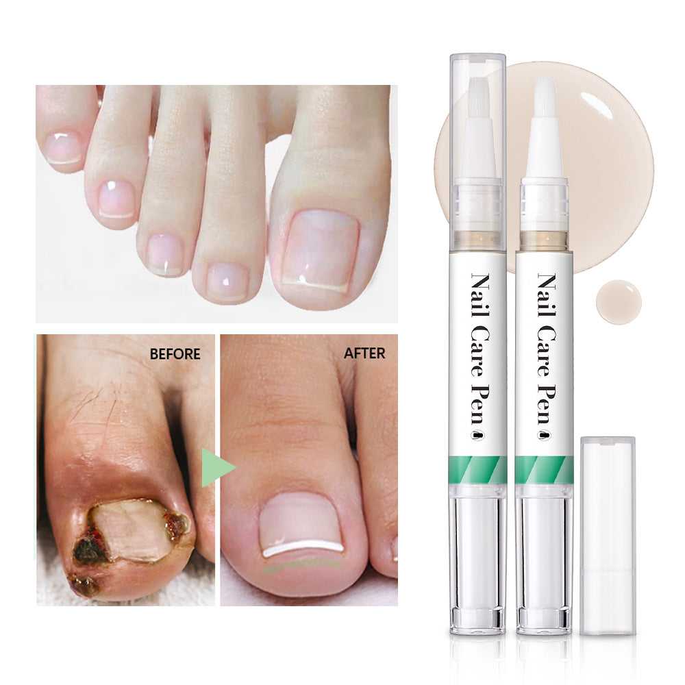 Nailixir™ - Nail Growth Treatment and Strengthener 50% Off - Luau Loot