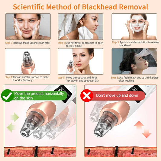 Vacufy™ - Electric Blackhead Remover 50% Off - Luau Loot