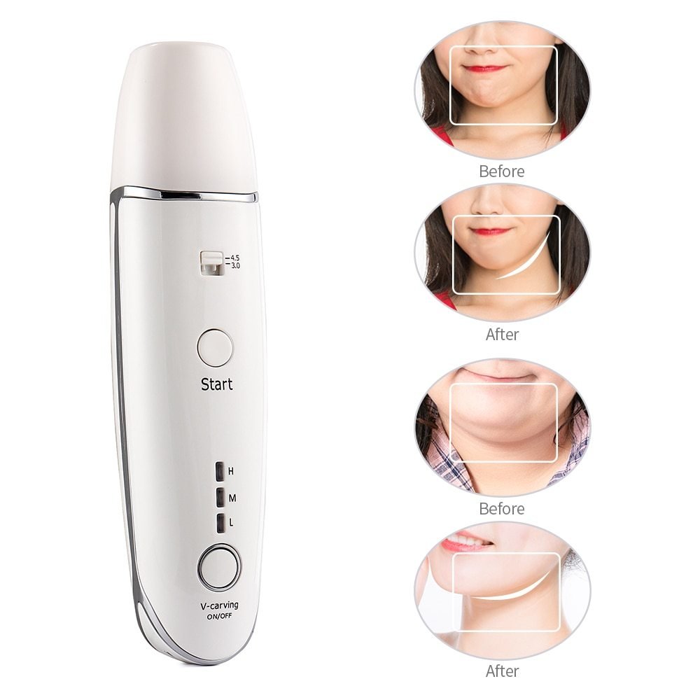 Anlan™ - Anti - Aging Skin Care Device 50% Off - Luau Loot