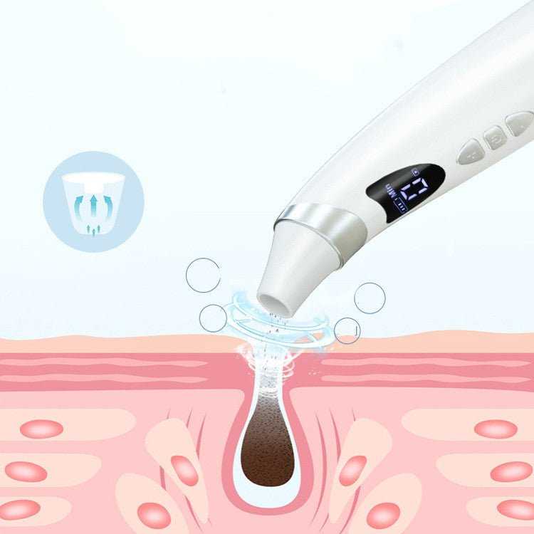 Electric Visual Blackhead Suction Instrument Household Cleansing Pore Cleaner For Skin Equipment Skin Care Tool - Luau Loot