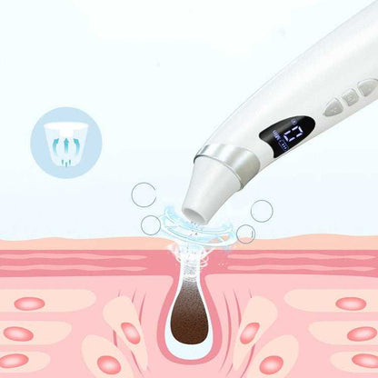 Electric Visual Blackhead Suction Instrument Household Cleansing Pore Cleaner For Skin Equipment Skin Care Tool - Luau Loot