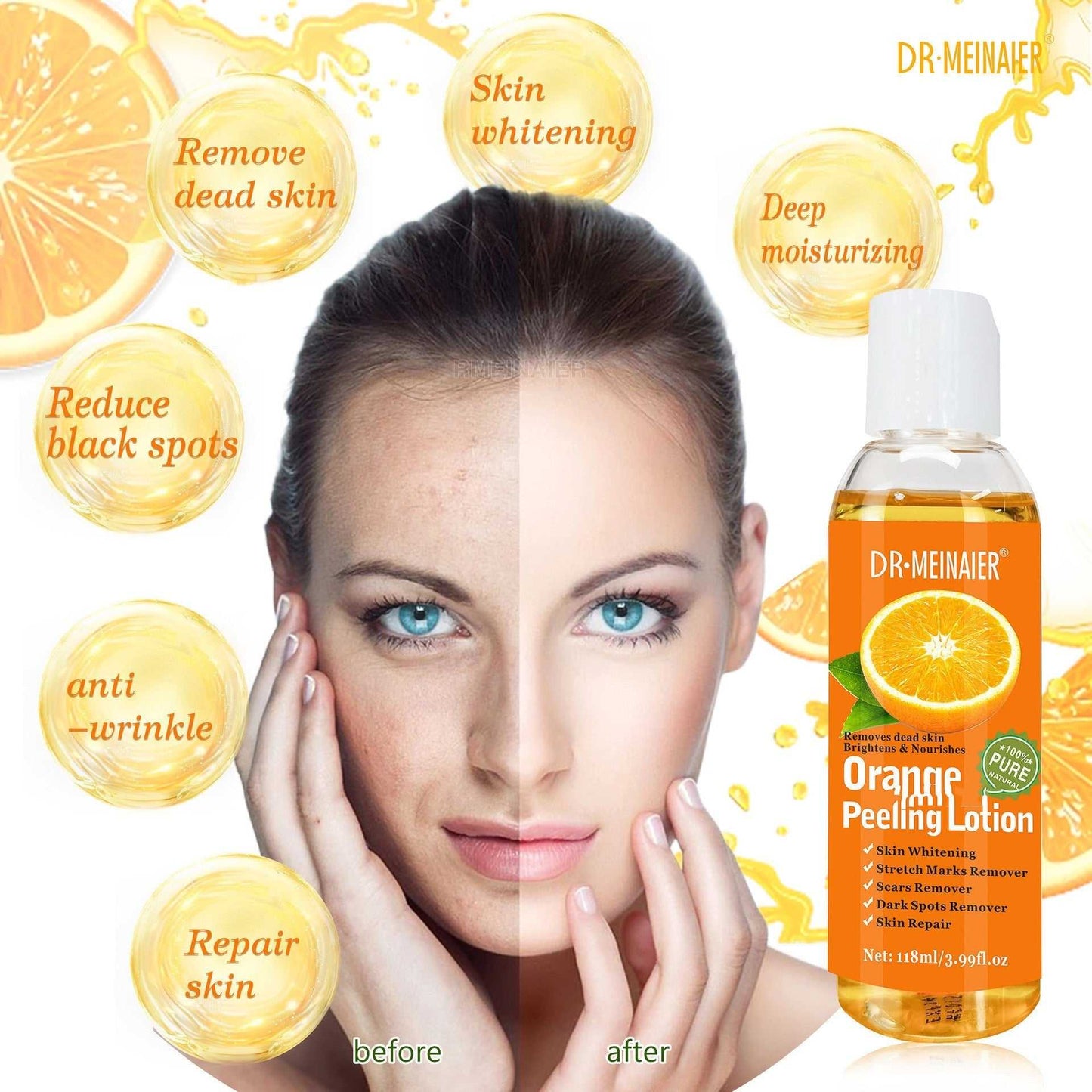 Fresh Orange Peeling Oil Remove Dead Skin From Hands And Feet - Luau Loot