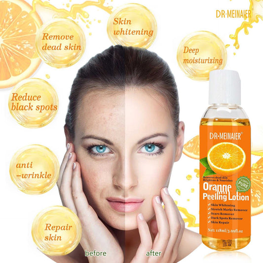 Fresh Orange Peeling Oil Remove Dead Skin From Hands And Feet - Luau Loot