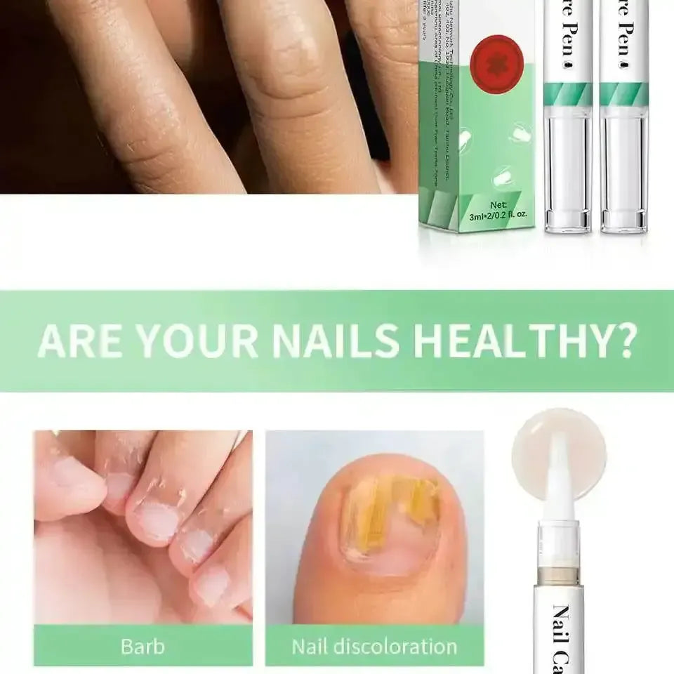 Nailixir™ - Nail Growth Treatment and Strengthener 50% Off - Luau Loot