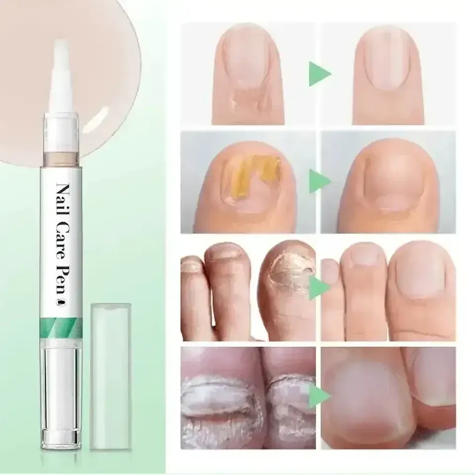 Nailixir™ - Nail Growth Treatment and Strengthener 50% Off - Luau Loot