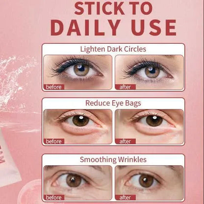 SkinReform™ - Retinal Liposome Eye Treatment