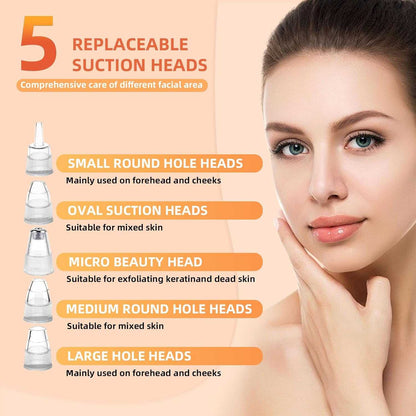 Vacufy™ - Electric Blackhead Remover 50% Off - Luau Loot