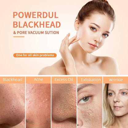 Vacufy™ - Electric Blackhead Remover 50% Off - Luau Loot